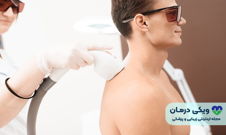 هزینه لیزر موهای زائد آقایان چقدر است؟