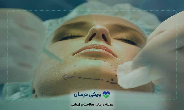 عوامل موثر بر قیمت پروتز صورت