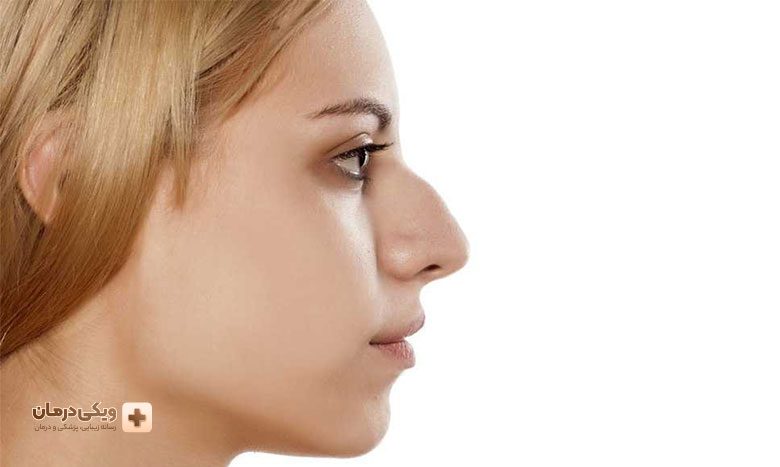 انواع روشهای انجام عمل بینی استخوانی