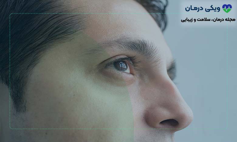 عمل بینی استخوانی برای انحراف بینی