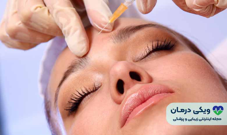 تزریق چربی به صورت