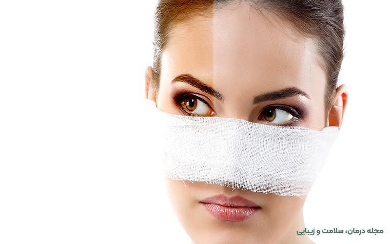 عمل بینی ترمیمی