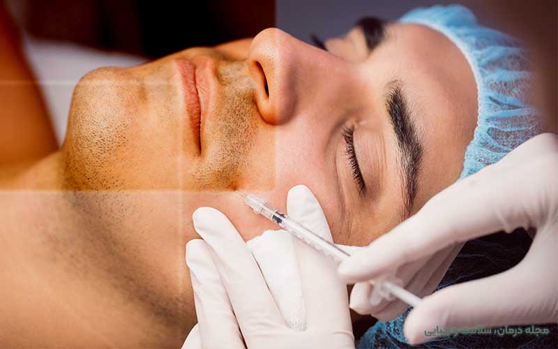پروتز صورت آقایان چگونه انجام می شود؟