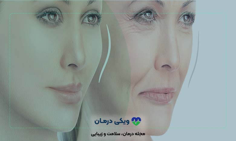 پروتز صورت لاغر