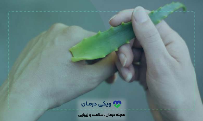 درمان-خانگی-سوختگی-پوست-با-عسل