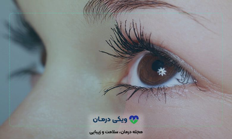 عوارض کاشت ابرو و مژه چه مواردی می باشند؟