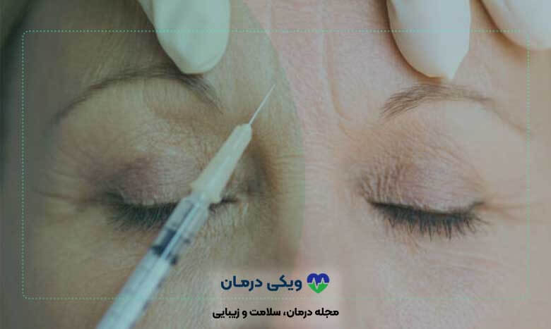 فرق بوتاکس با تزریق چربی