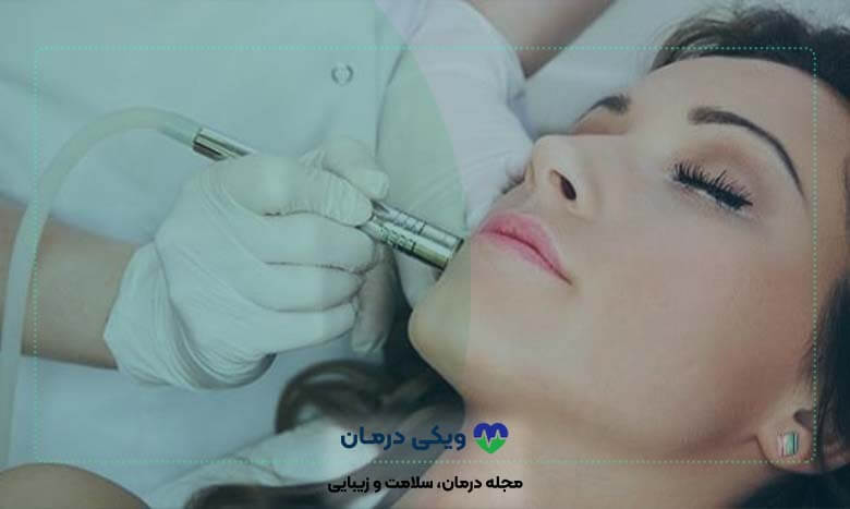 میکرودرم-ابریژن-چیست؟
