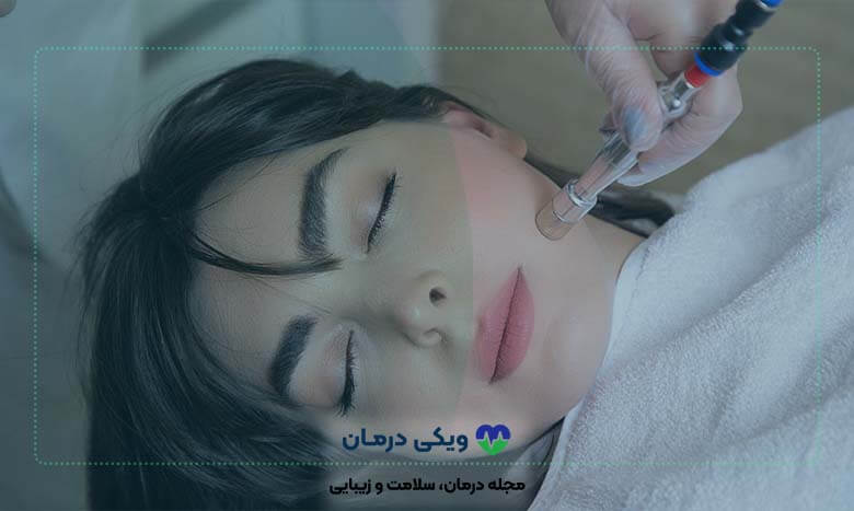 هزینه-میکرودرم-ابریژن