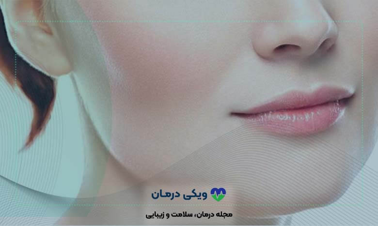 پروتز گونه