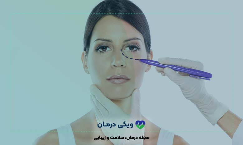 راه های کاشت گونه