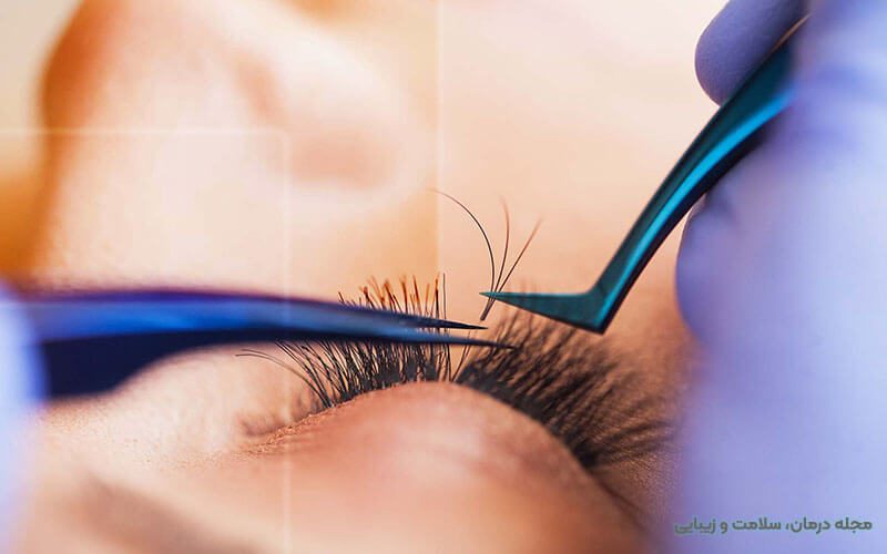 عوارض کاشت ابرو و مژه