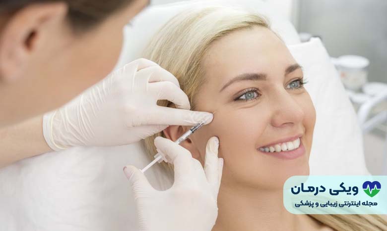 تزریق ژل صورت