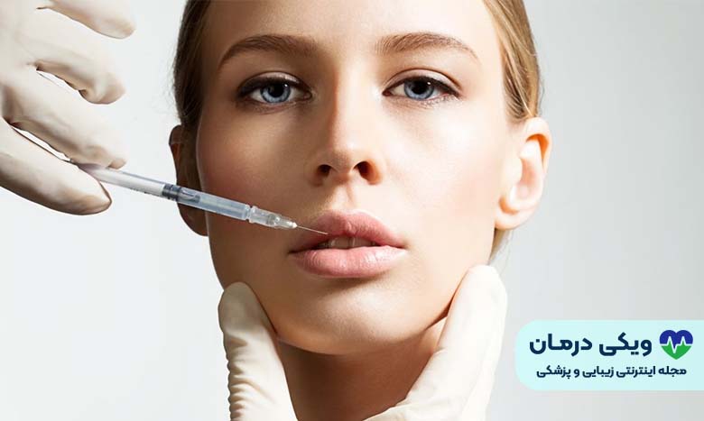 تزریق ژل