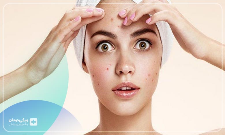 مزونیدلینگ جای جوش
