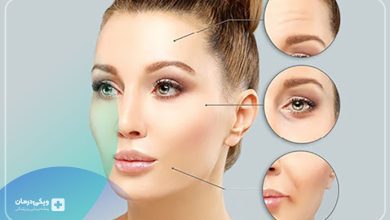 محل تزریق بوتاکس میگرن