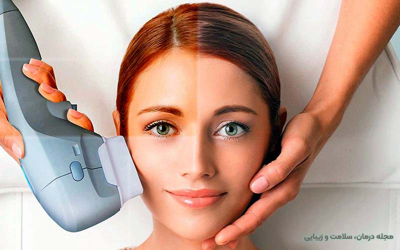 مزایای جوانسازی پوست با هایفو