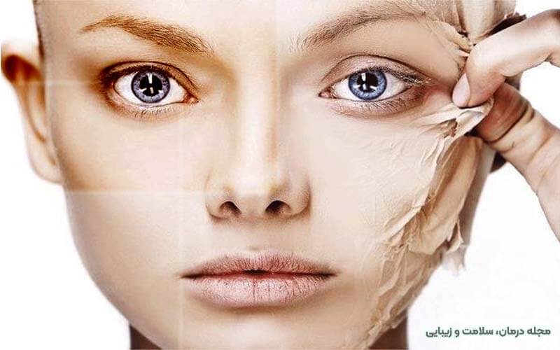 ترمیم سوختگی پوست