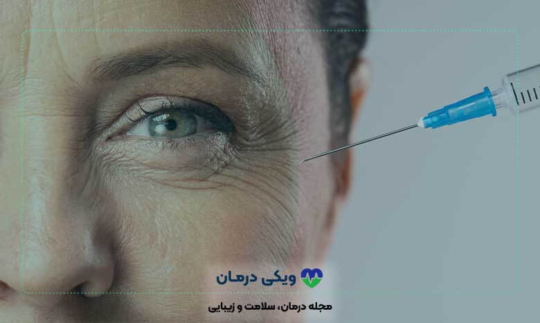 عوارض تزریق ژل و بوتاکس