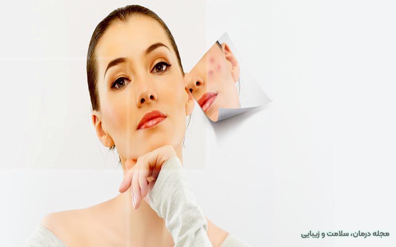 هزینه هیدرودرم ابریژن
