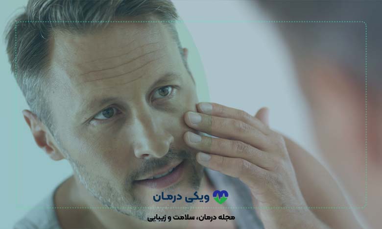 درمان چین و چروک پوست