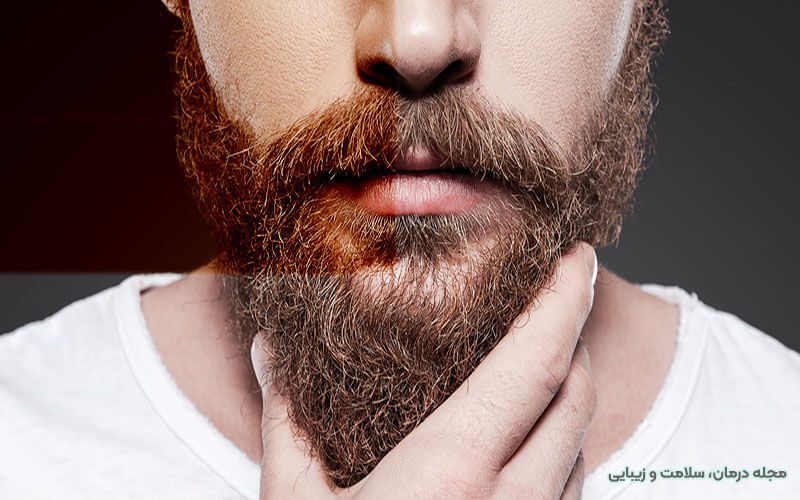 هزینه کاشت زیش و سبیل