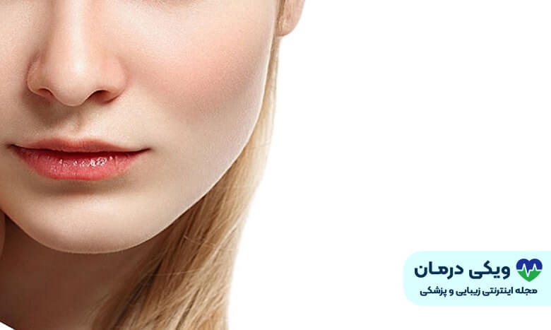 جراحی فک بالا جلو آمده