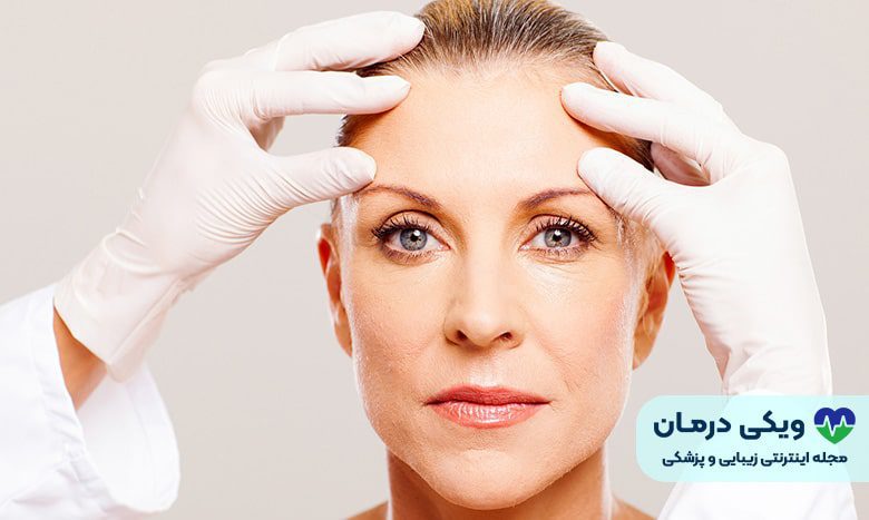 لیفت شقیقه با ویکی درمان