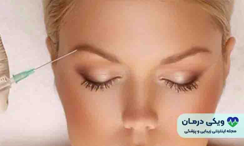 هزینه کربوکسی تراپی دور چشم
