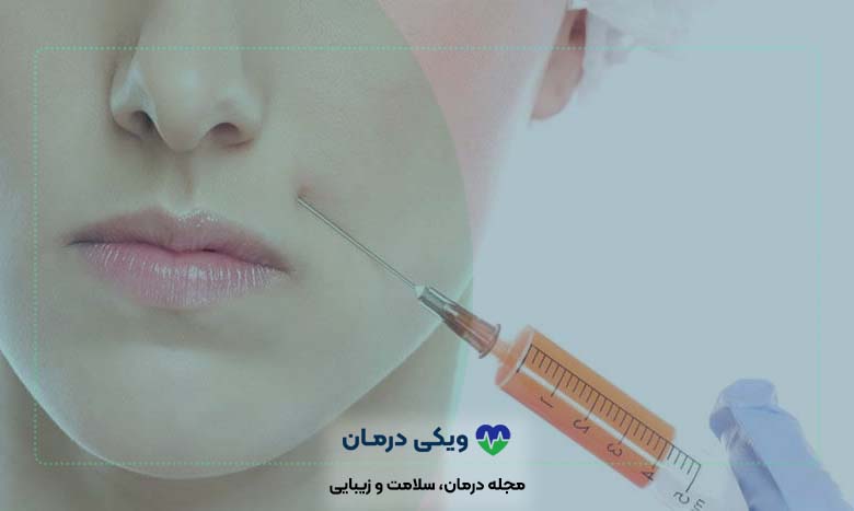 ماندگاری تزریق ژل چه تضمینی دارد