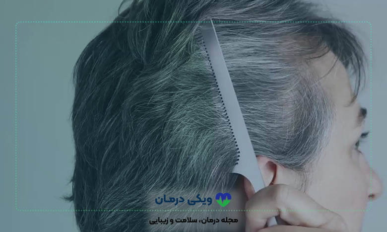 روش های خانگی درمان سفیدی مو