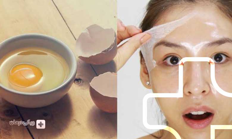 انواع ماسک کنترل کننده چربی پوست