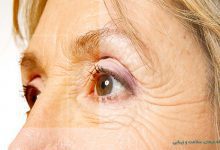روش های لیفت چشم در خانه