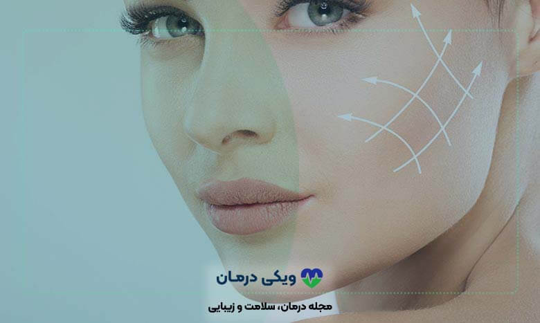 گونه های پروتز شده