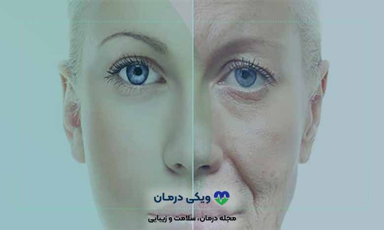 آر اف کونتراج برای جوانسازی پوست