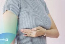 هزینه لیفت سینه با نخ