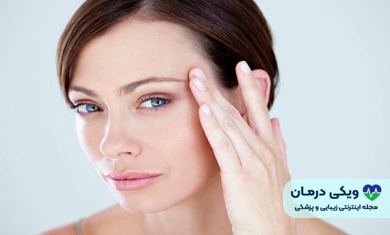 لیفت شقیقه