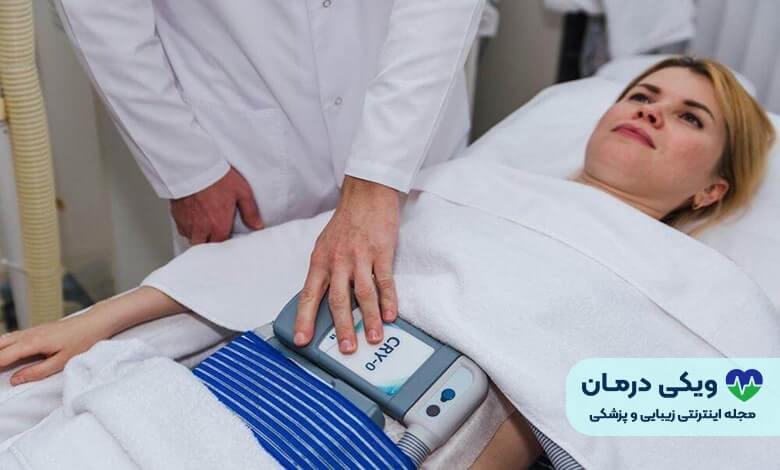 پیکر تراشی با لیزر