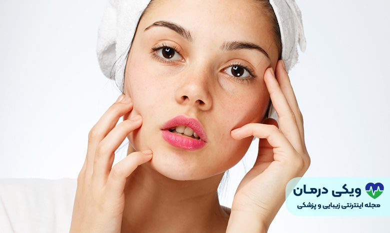 چگونگی لیفت شقیقه