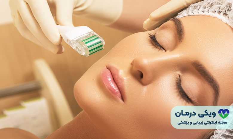 فواید میکرونیدلینگ