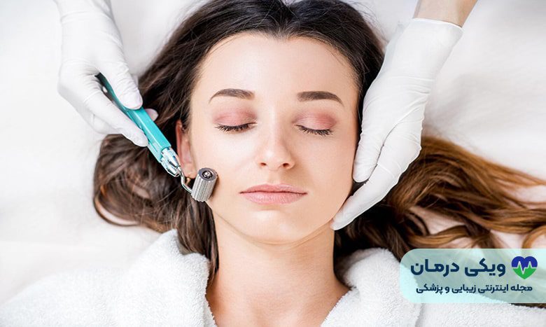 مراحل میکرونیدلینگ