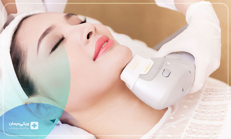 هایفوتراپی غبغب چیست و چگونه انجام می‌شود؟