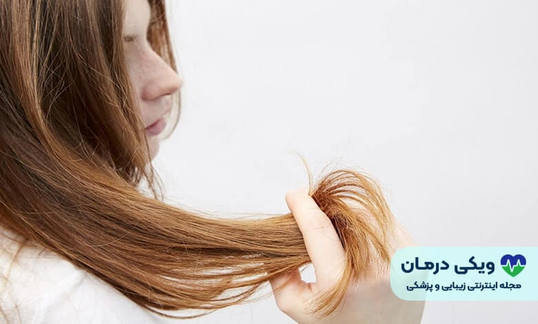 پروتز مو