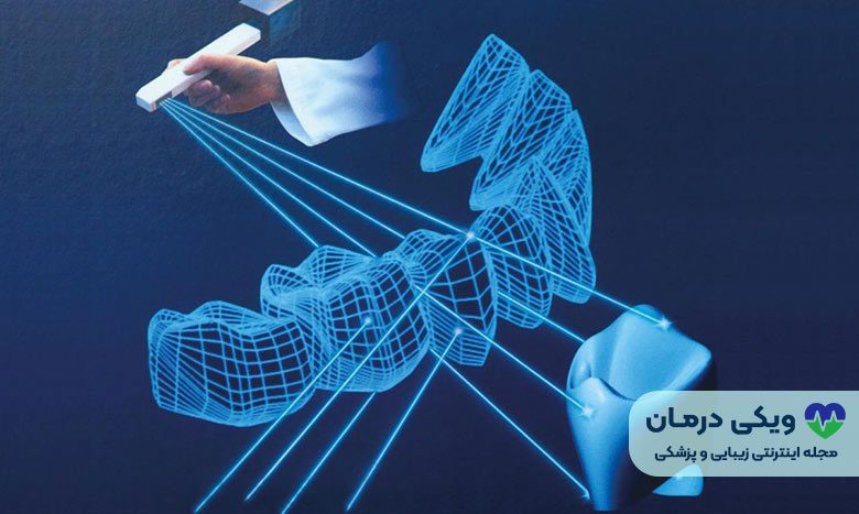 اسکن سه بعدی ایمپلنت دیجیتال