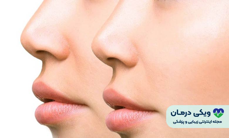بهترین جراح بینی در تهران کیست؟