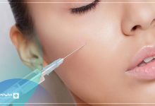بهترین دکتر تزریق ژل پروفایلو تهران