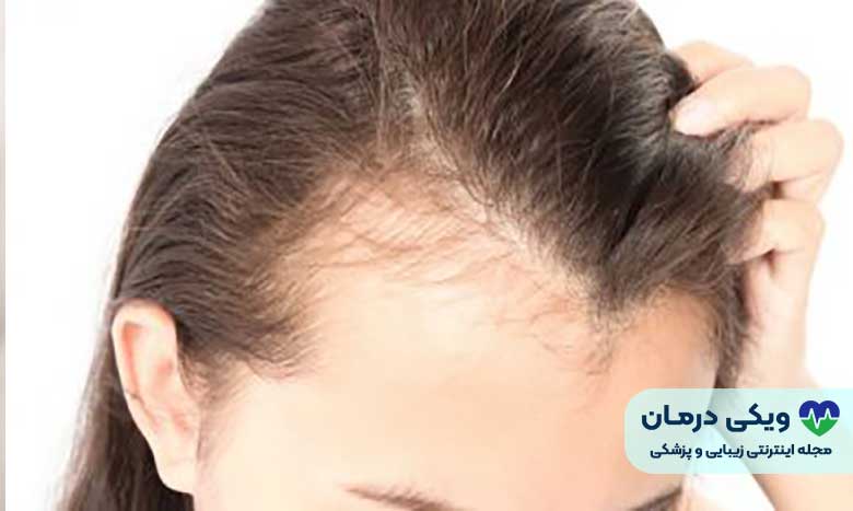 بانک موی ضعیف