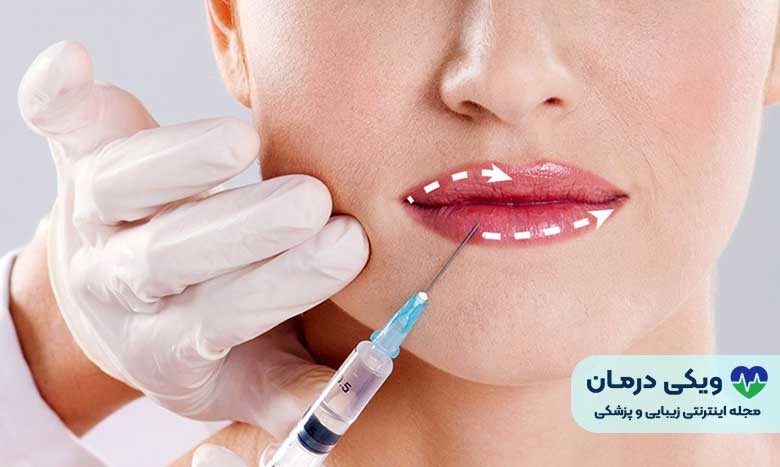 انواع بهترین جراحی لب