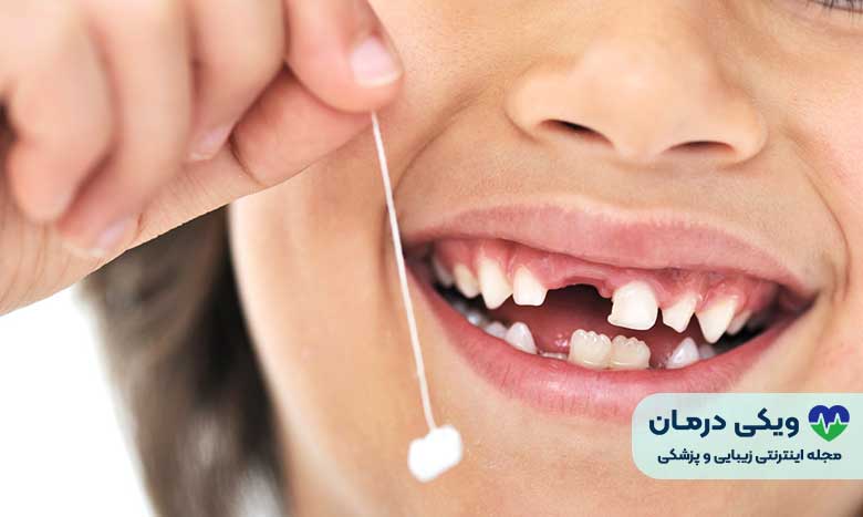 دندان شیری
