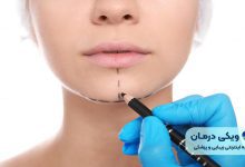 جراحی همزمان فک و بینی